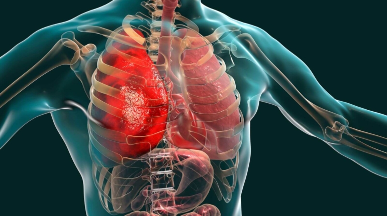 diagram:ky-cugf4blq= respiratory system